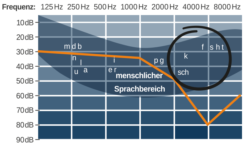 Grafik des Sprachspektrums mit Hörverlust-Kurve